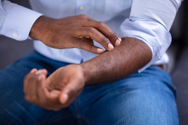 man scratching a rash on his arm, a sign of chronic inflammation